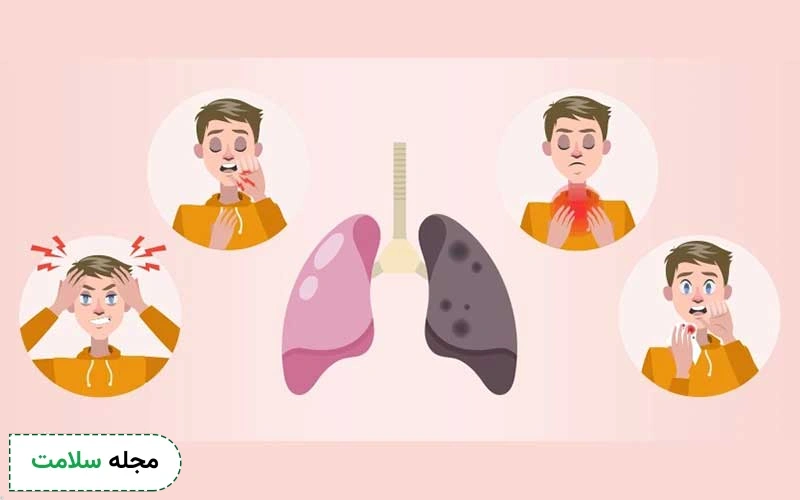 علائم سرطان ریه بدخیم (علائم سرطان ریه پیشرفته) چیست؟