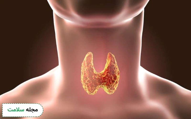 بررسی تمامی علائم تیروئید کم کار