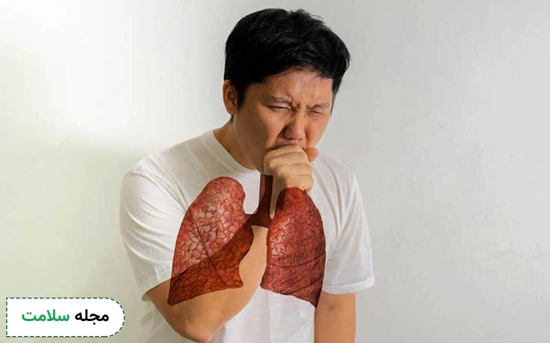 علائم پیشرفته سرطان ریه در مردان چگونه است؟