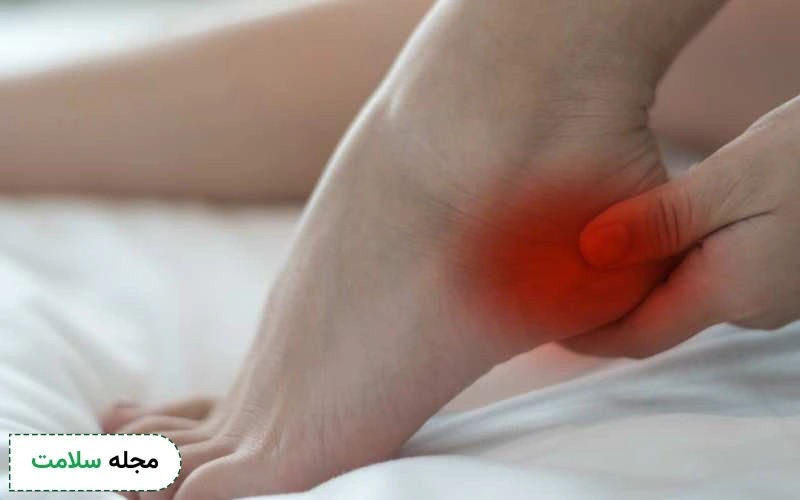 خار پاشنه شدید چه علائمی دارد؟