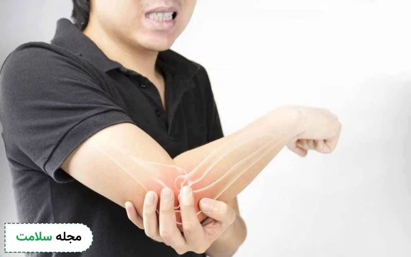 درباره تورم مفاصل چه می دانید؟