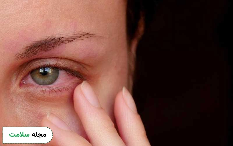 پارگی و التهاب رگهای خونی بر اثر ساکشن دستگاه لیزر امکانپذیر است.