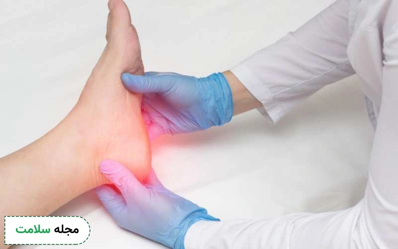 نحوه تشخیص خار پاشنه چگونه است؟