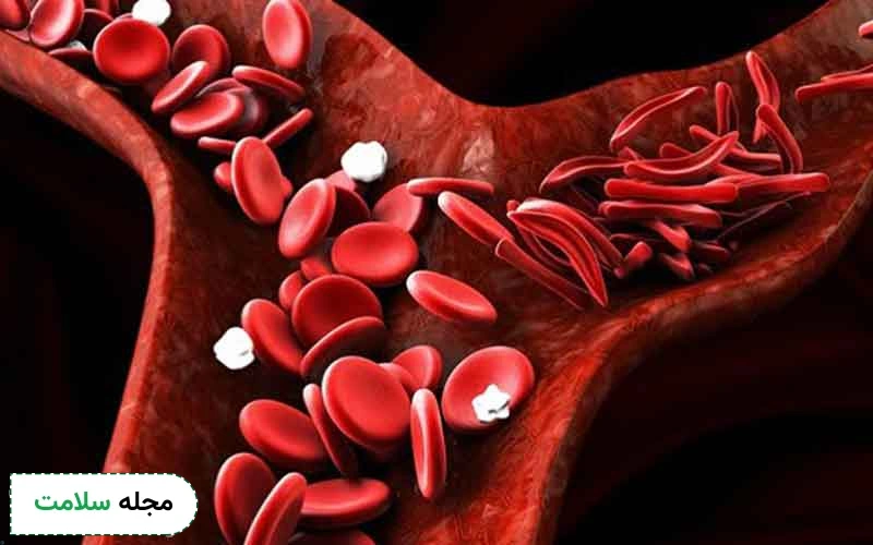علائم تالاسمی را بشناسیم