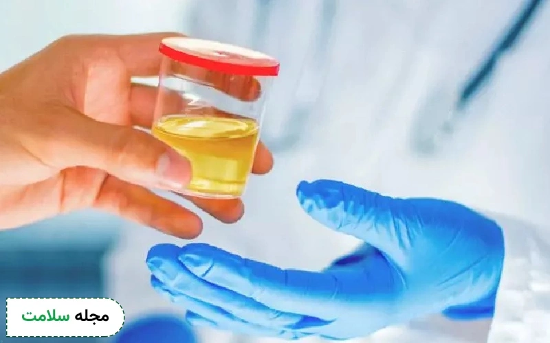 دلیل ادرار بدبو چگونه تشخیص داده می شود؟