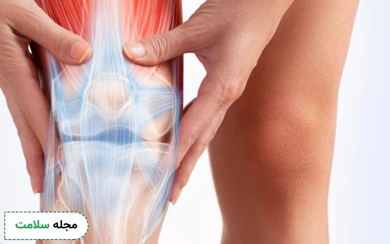تورم و التهاب از علائم ساییدگی زانو