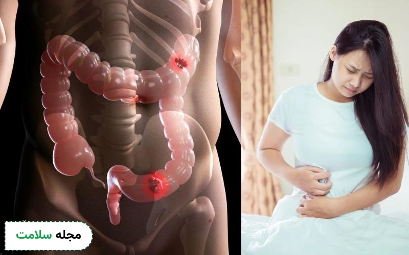 بررسی تمامی بیماریهای دستگاه گوارش و میزان خطرناک بودن آنها