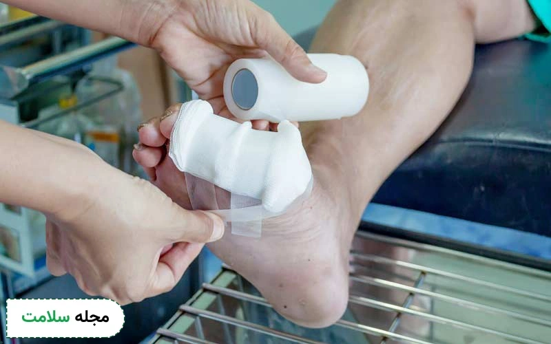 تمام بایدها و نبایدها درباره نحوه پانسمان زخم پای دیابتی