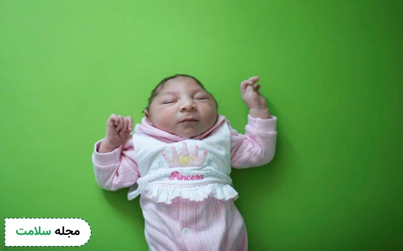 همه آنچه باید درباره میکروسفالی بدانید.