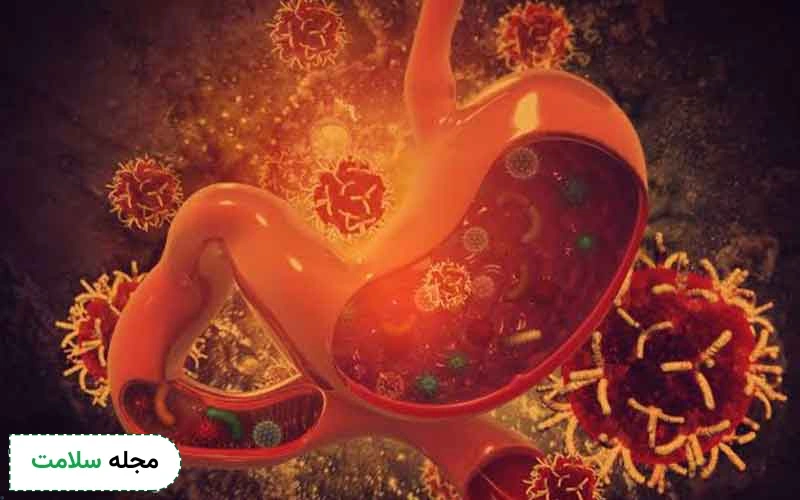 چقدر با سرطان معده بدخیم آشنا هستید؟