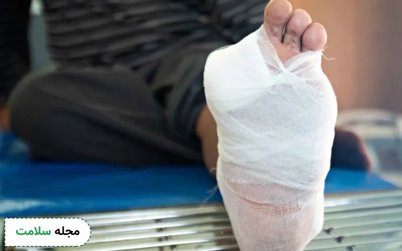 راهنمای مراقبت از زخم پای دیابتی به همراه تمام اصول و راهکارها