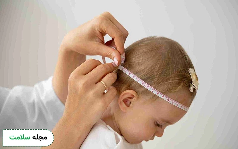 میکروسفالی خفیف چیست و آیا امکان درمان وجود دارد؟