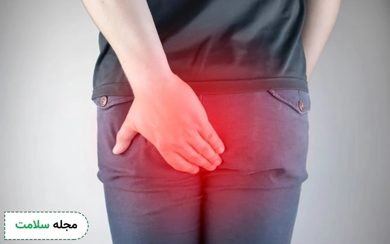 نشستن طولانیمدت و تعریق زیاد میتواند باعث تحریک و عود فیستول شود.