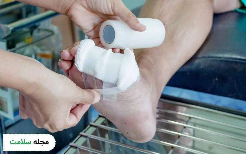 چه زمانی زخم پای دیابتی نیاز به مراجعه فوری به پزشک دارد؟