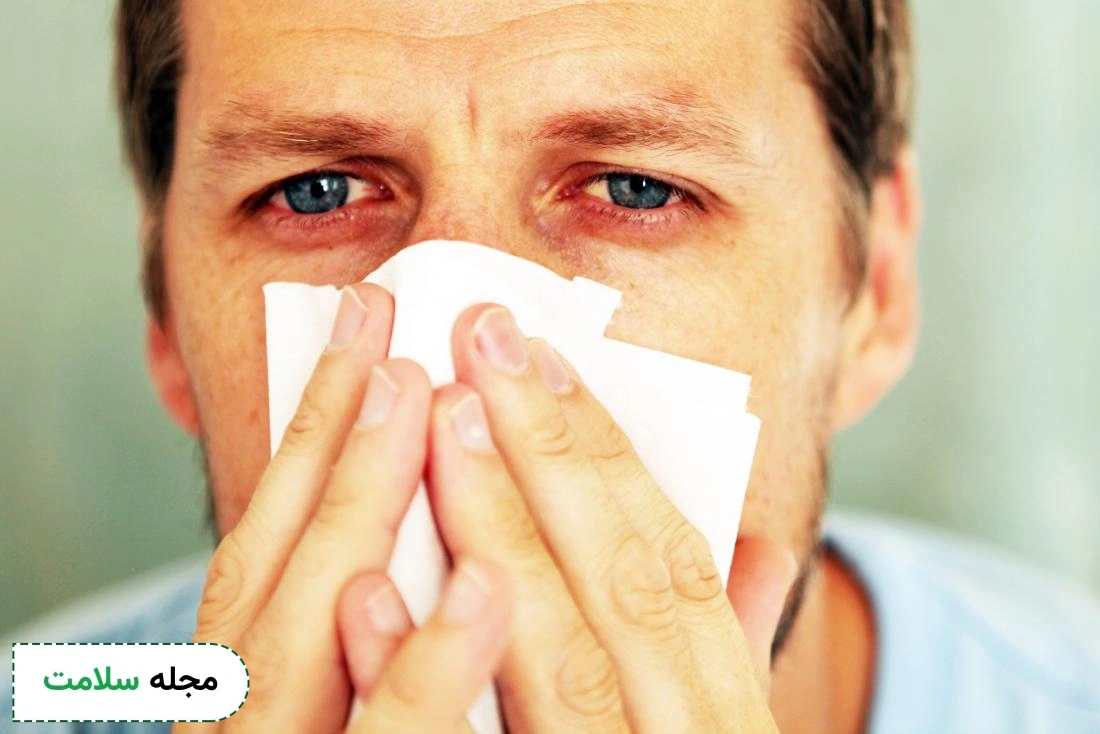 red eyes in flu