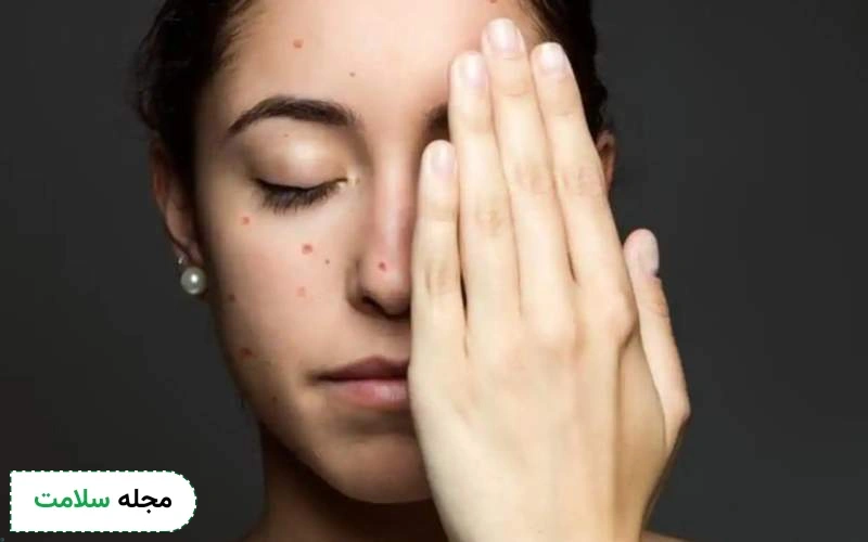 جای ابله مرغان چقدر باقی می ماند؟