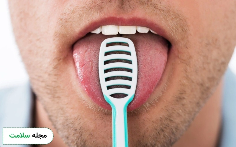 برای از بین بردن بوی بد دهان چکار کنیم؟