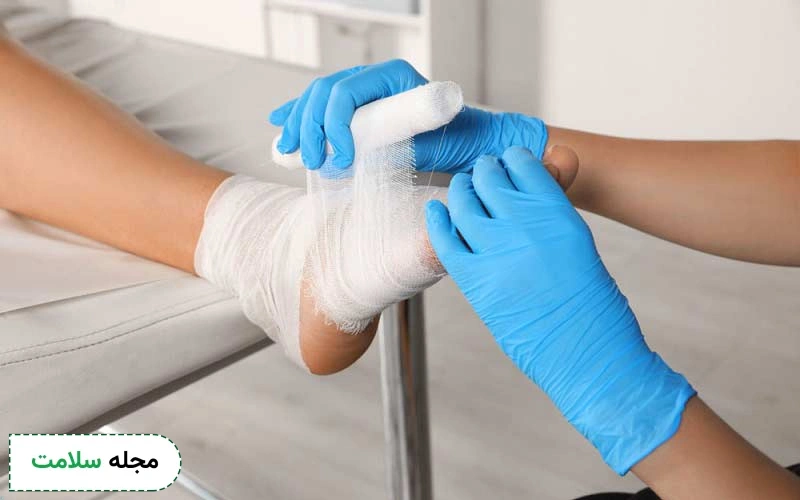 انواع پانسمان مناسب زخم پای دیابتی وجود دارد.