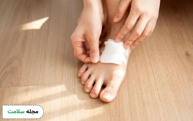بررسی تمامی روش های درمان خانگی زخم پای دیابتی
