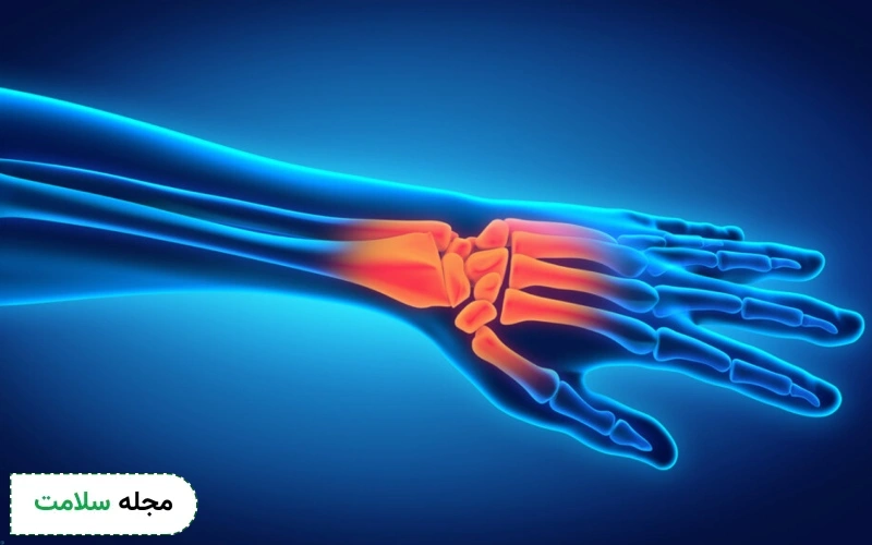 عمل جراحی مچ دست چگونه است؟