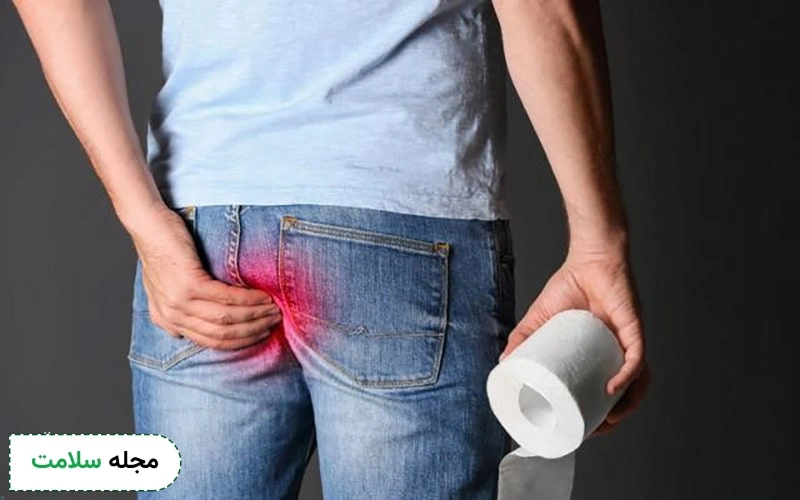 تفاوت روشهای تشخیص زگیل مقعدی و بواسیر توسط پزشک چگونه است؟