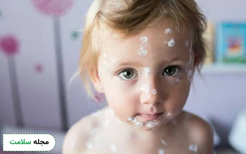 بررسی نوشیدنیهای مناسب برای ابله مرغان