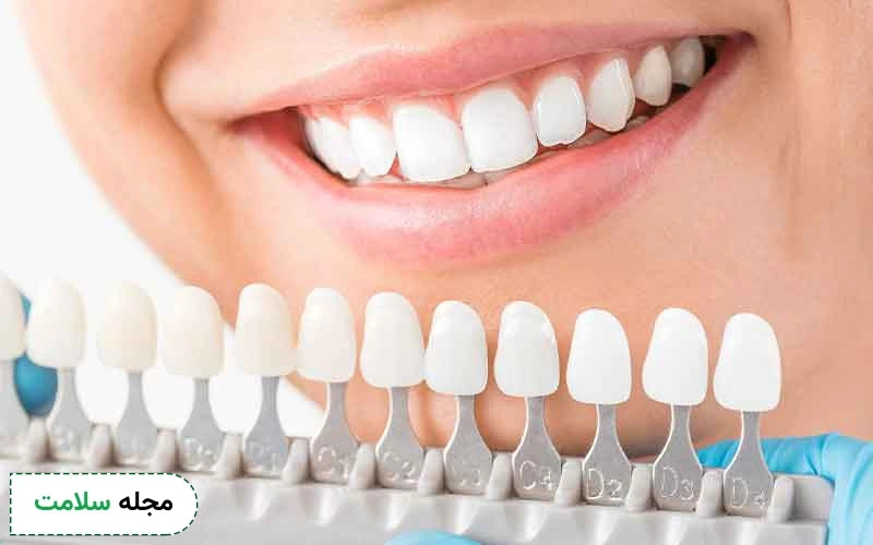 همه چیز درباره فاصله بین عصب کشی و روکش دندان