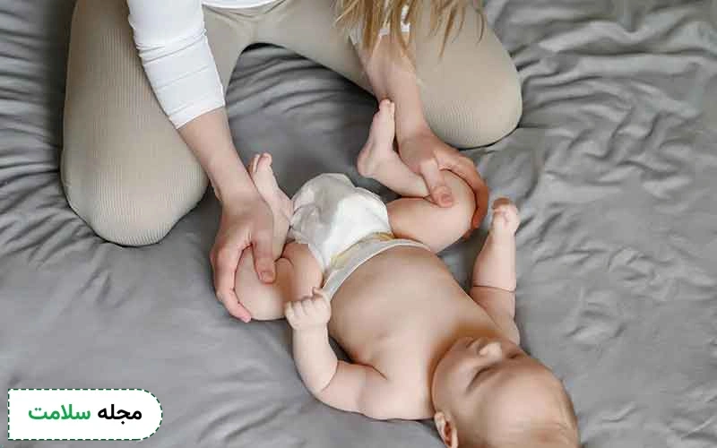 همه چیز درباره پای پرانتزی در کودکان