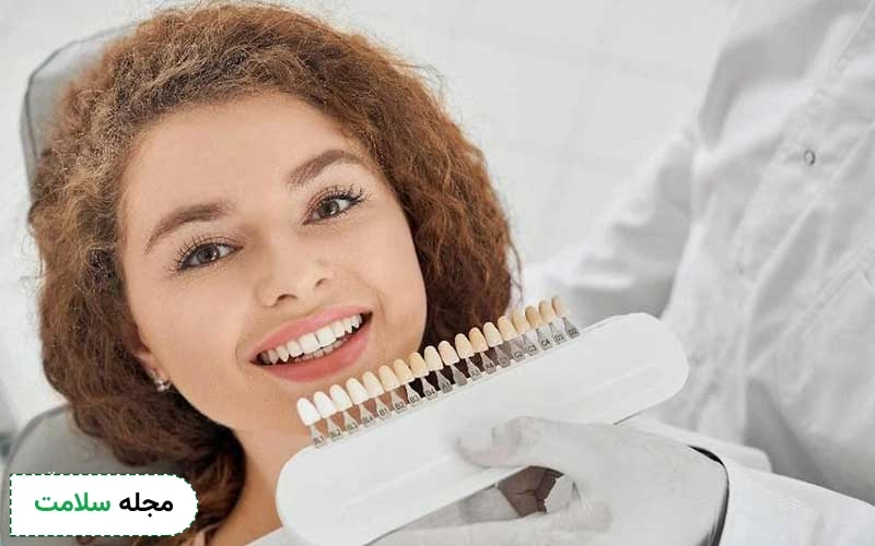 همه چیز درباره عمر روکش دندان زیرکونیا
