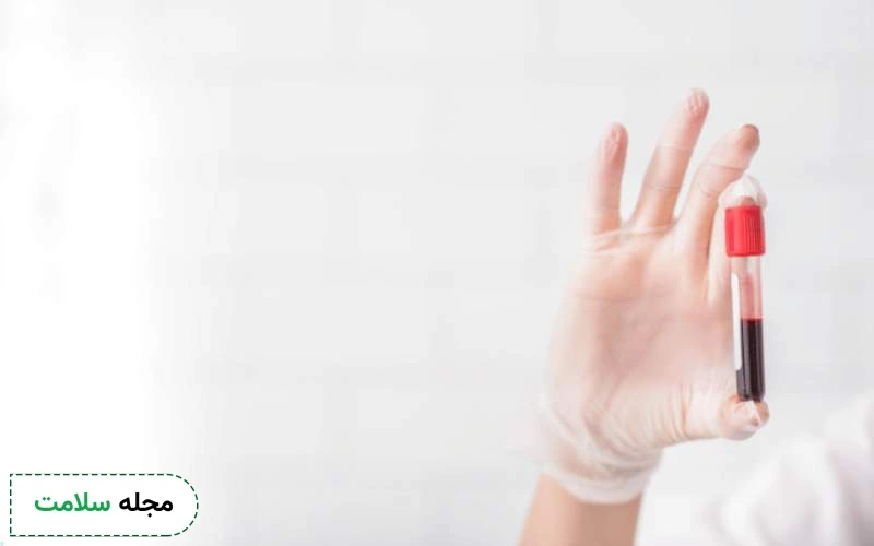 تشخیص هموکروماتوز چگونه است؟