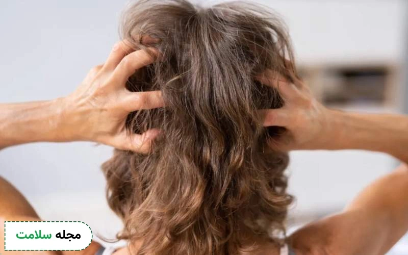 راه های پیشگیری از سرطان پوست سر چگونه است؟