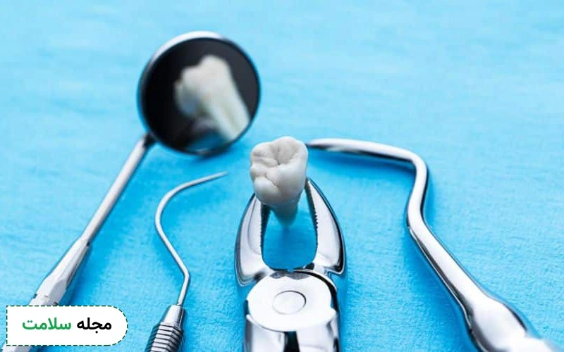 همه چیز درباره کشیدن دندان ؛ از آمادگی تا مراقبت های بعد آن