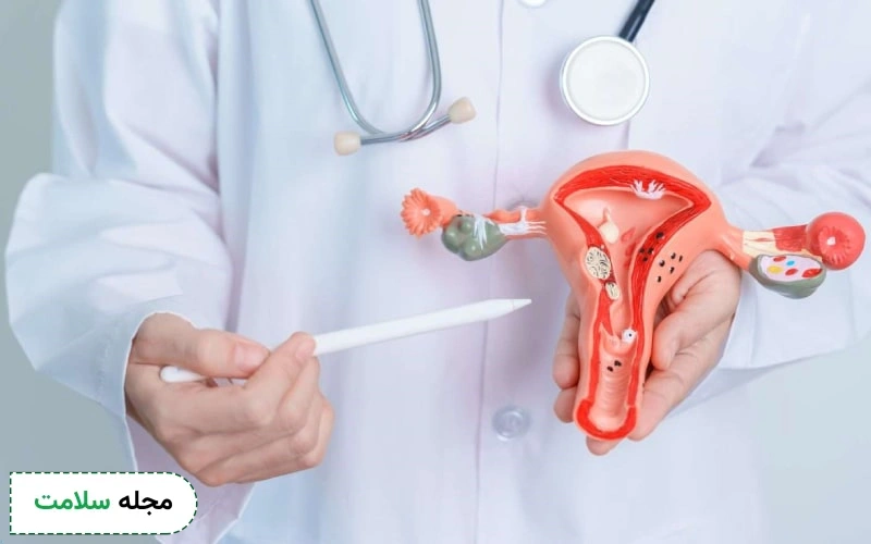 علائم تنبلی تخمدان در سنین پایین چگونه است؟
