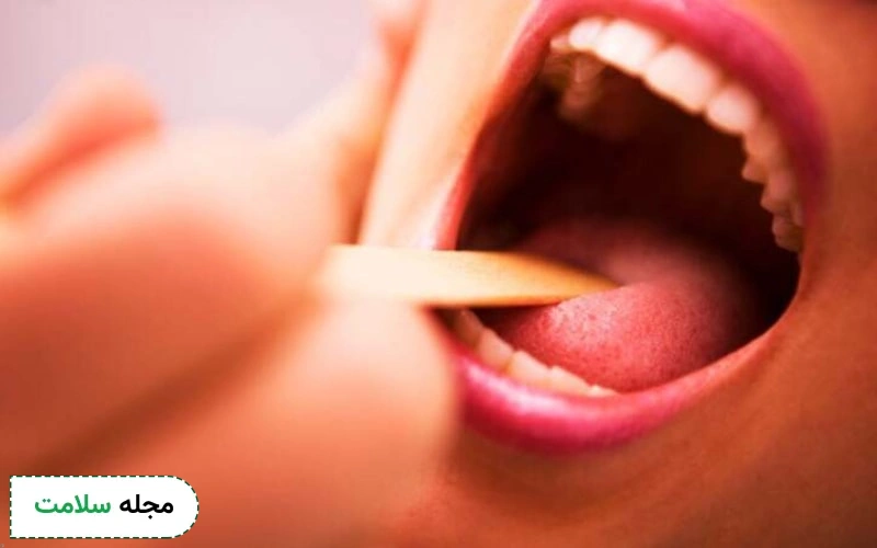 کشت قارچ برای تشخیص HIV مهم است.