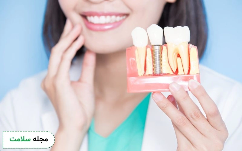 دندان چسبی بهتر است یا ایمپلنت؟