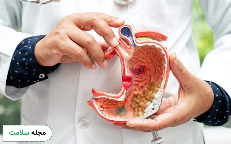 تشخیص زودهنگام سرطان معده چگونه انجام می شود؟