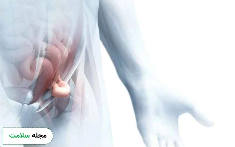 عکس فتق بیضه
