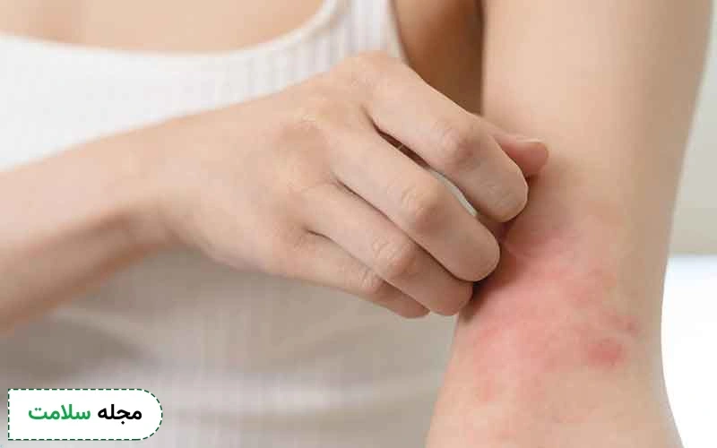دیابت و بیماری پوستی چه ارتباطی با هم دارند؟