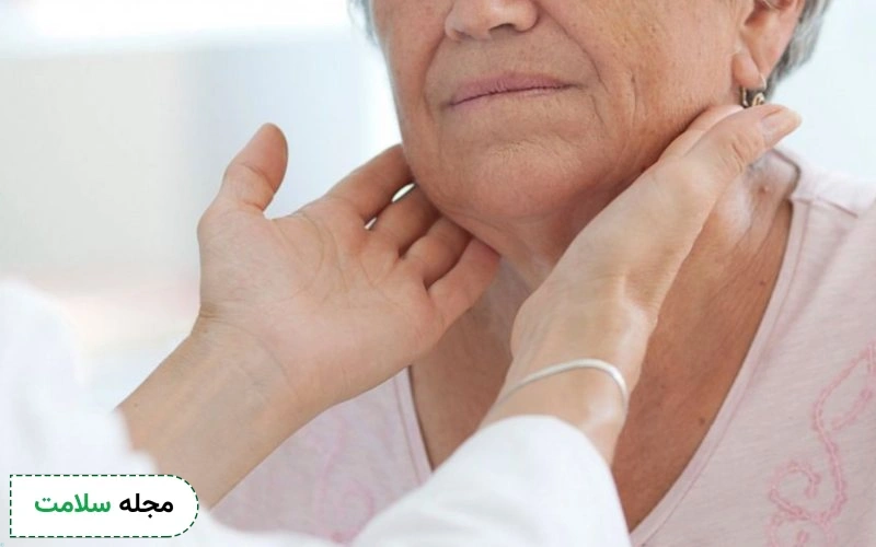 آیا کم کاری تیروئید باعث جوش صورت می شود؟