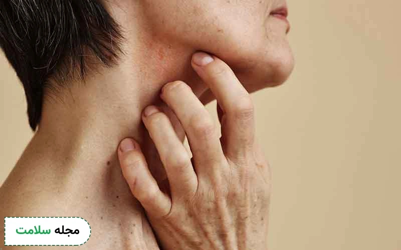 درمان راش پوستی از چه را‌ه هایی ممکن است؟