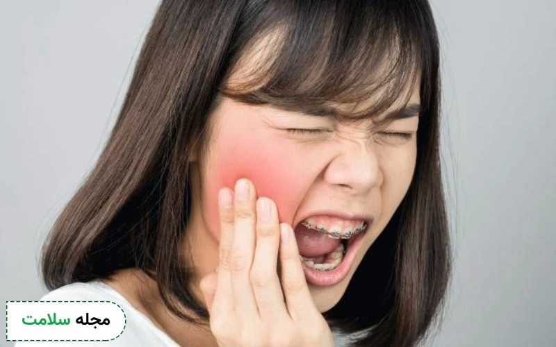 راه ‌های پیشگیری از در رفتگی فک چیست؟
