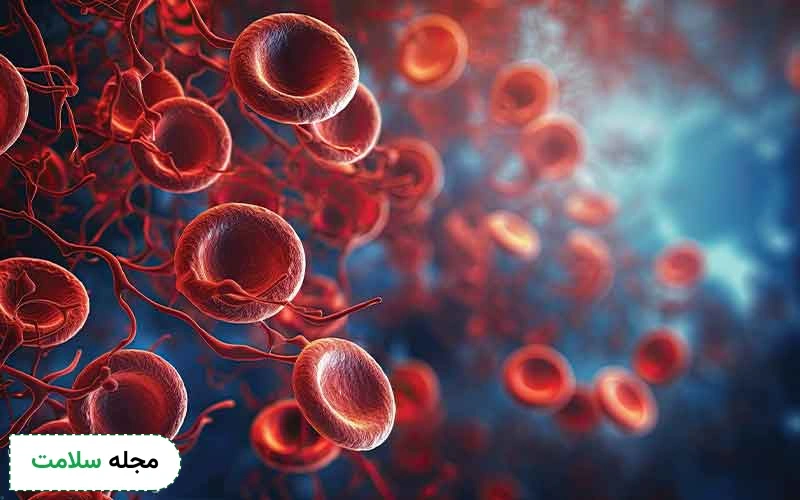 هموفیلی ماژور چیست و چه علائمی دارد؟