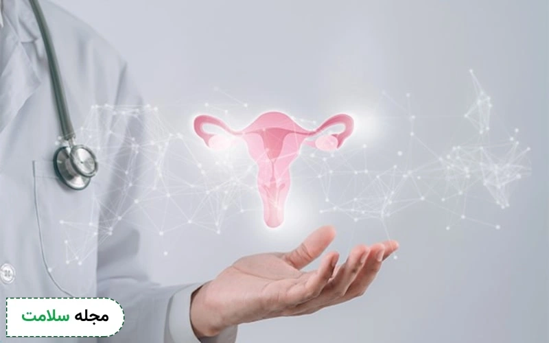 علت تخمدان پلی کیستیک چیست و چرا این اختلال هورمونی رخ می دهد؟