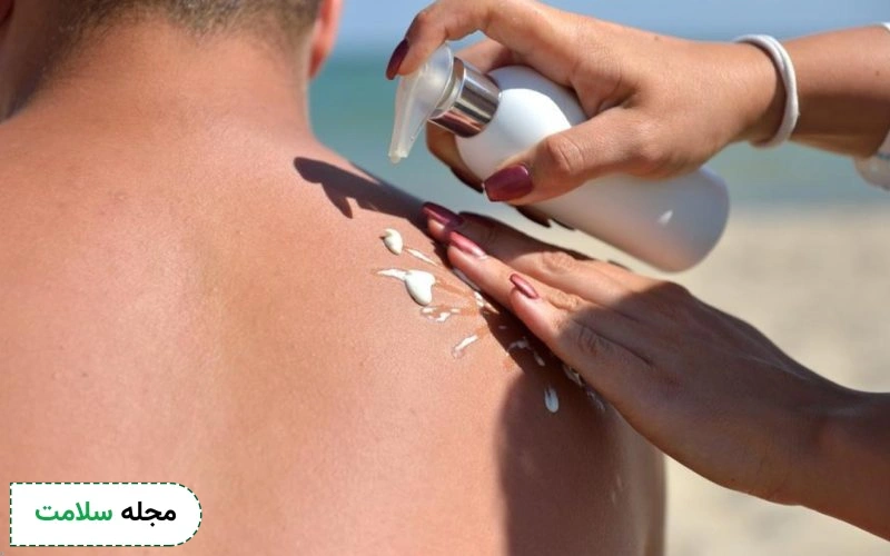 کدام علت سرطان پوست تاثیر بیشتری دارد؟