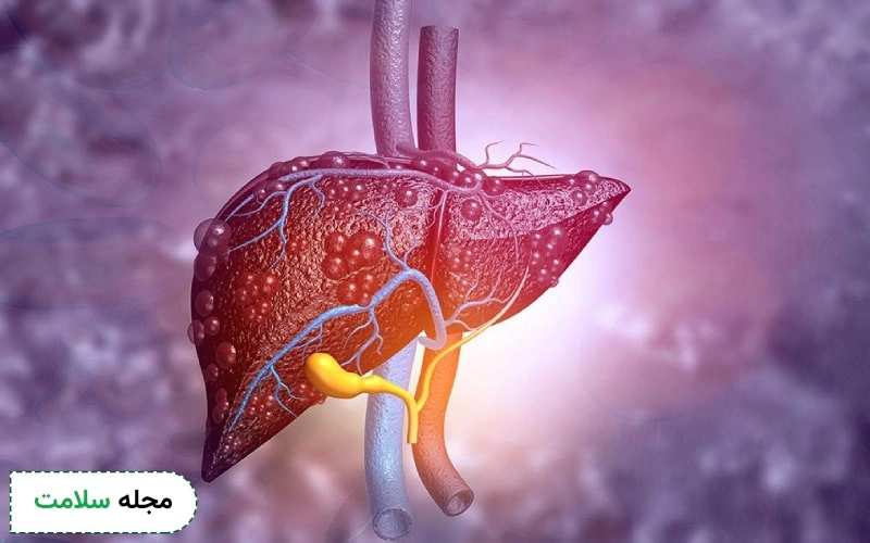 طول عمر افراد مبتلا به هپاتیت C چقدر است؟