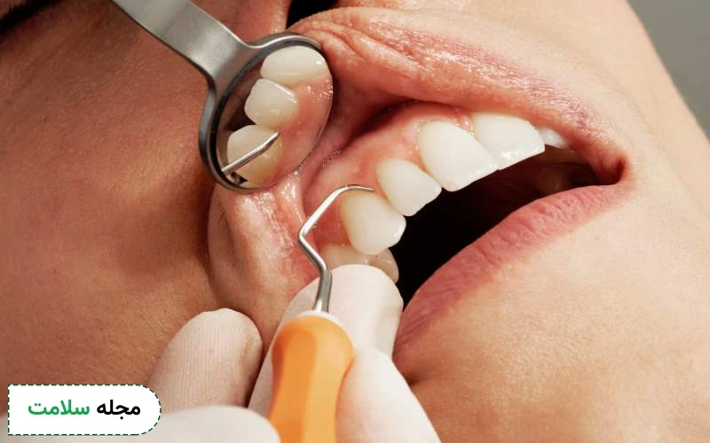 کاربردهای کاشت دندان چیست؟