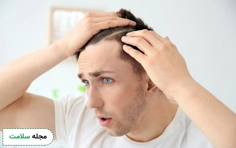 تاثیر تیروئید کم کار بر روی پوست و مو تا چه اندازه است؟