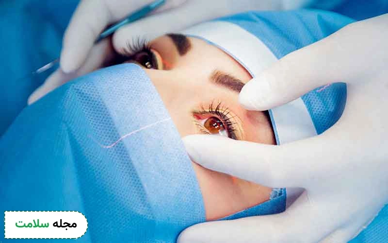 عدم بهبود کامل عیوب چشم ‌ها از عوارض لیزیک چشم هستند.
