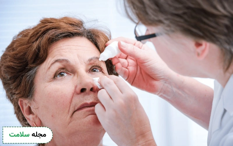 نکات بهداشتی در دوران نقاهت بعد از عمل آب مروارید چیست؟