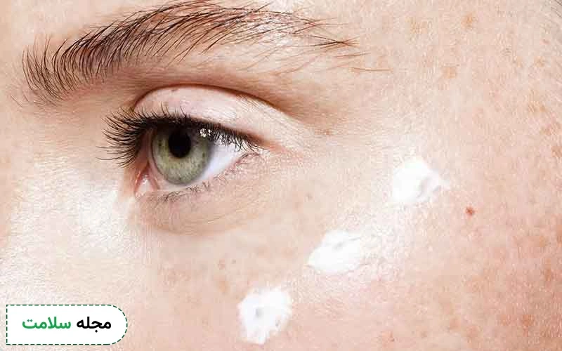 از بین بردن لک صورت در خانه چگونه است؟